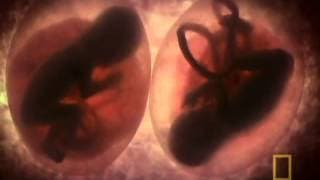 National Geographic   In The Womb Multiples