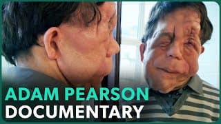 The Ugly Face of Disability Hate Crime (Adam Pearson Documentary) | Real Stories