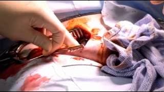Embarrassing bodies ep 1
